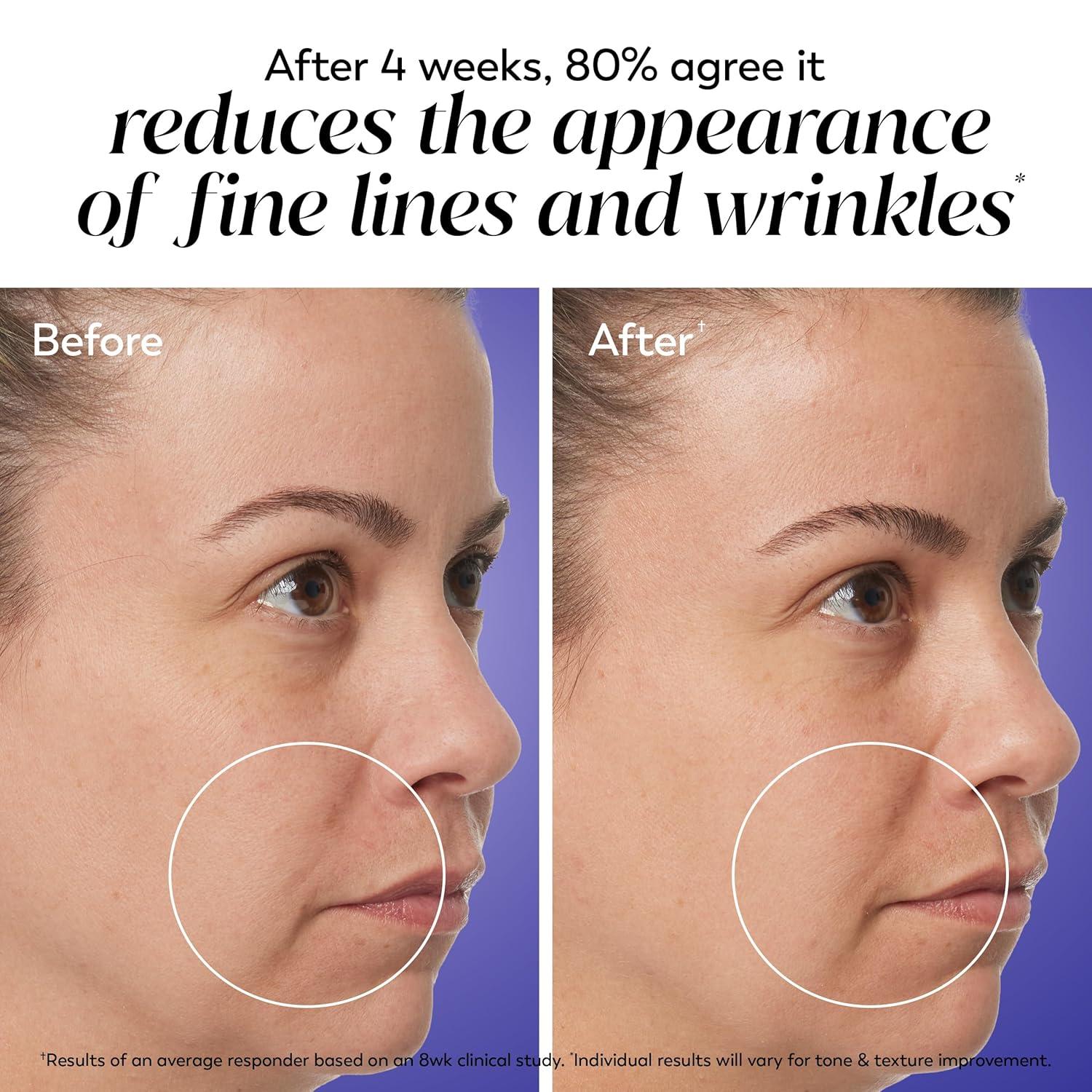 imageOlay Regenerist Radiance Retinol Face Moisturizer Smooth amp Renew Cream for Women FragranceFree AntiAging AntiWrinkle Tightening amp Brightening 2 Oz2 Ounce Pack of 2