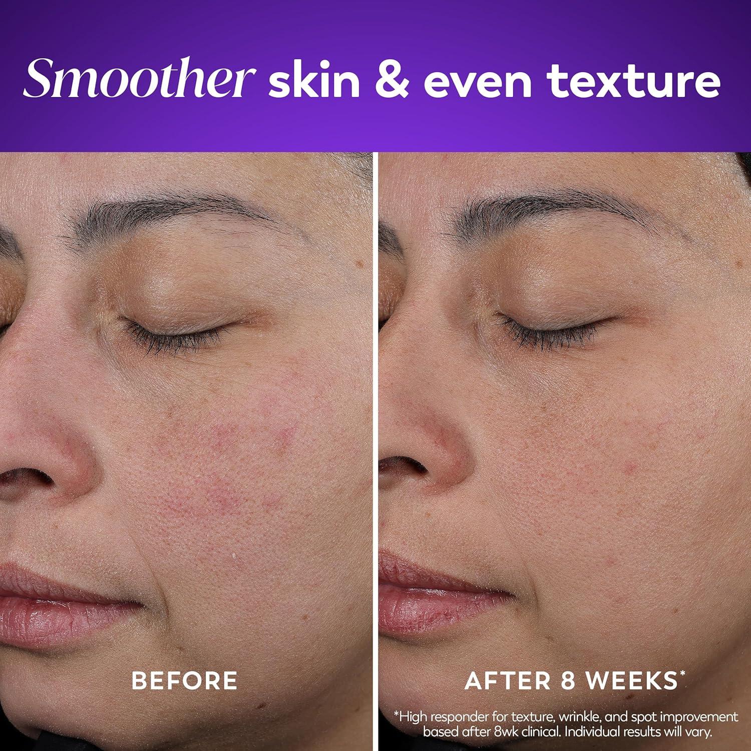 imageOlay Regenerist Radiance Retinol Face Moisturizer Smooth amp Renew Cream for Women FragranceFree AntiAging AntiWrinkle Tightening amp Brightening 2 Oz17 Fl Oz Pack of 1