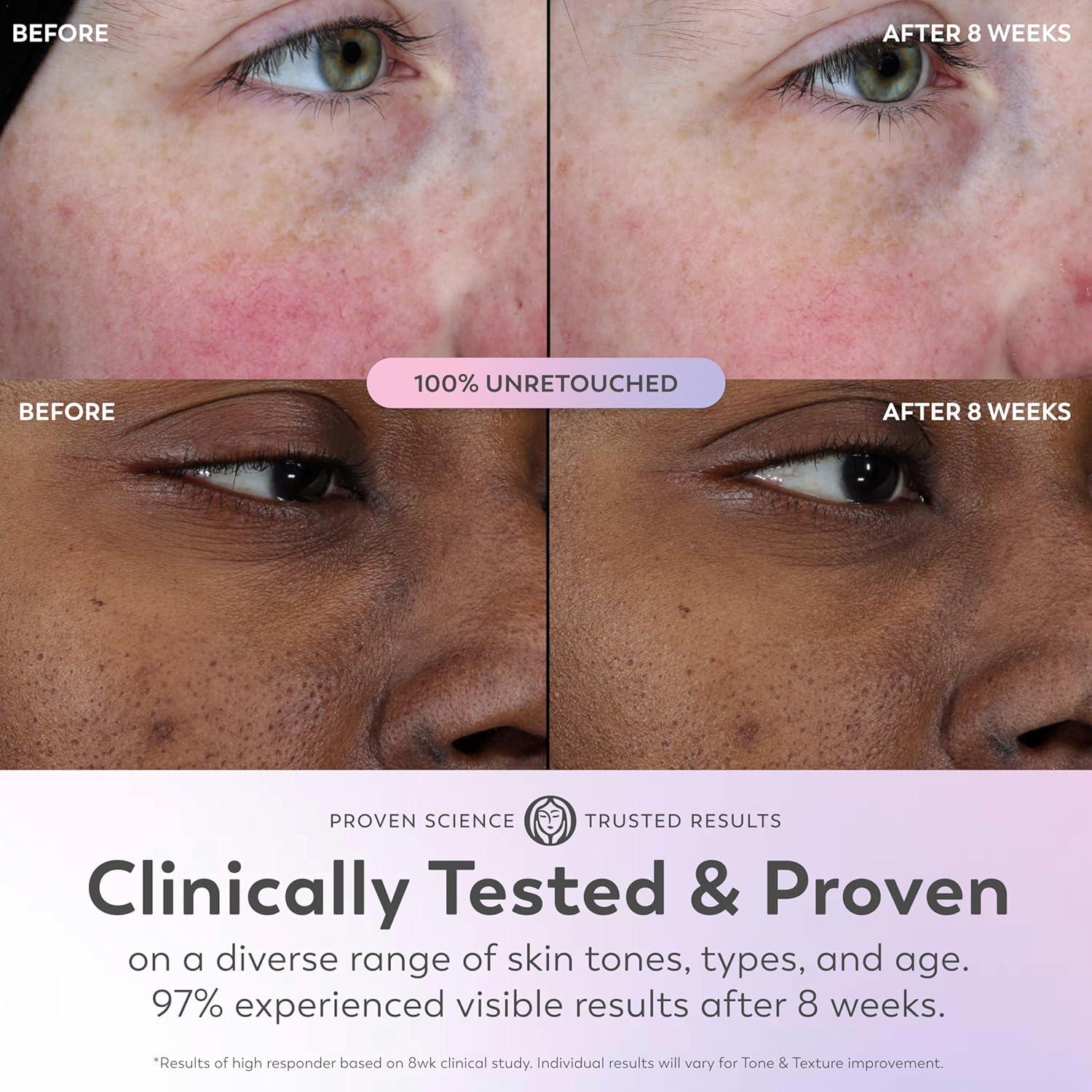 imageOlay Super Serum Glow Serum for Face Activated Niacinamide Vitamin C amp E Collagen Peptide AHA 5in1 Benefits Brightens Hydrates Smooths Firms Evens Tone Proactive AntiAging 10 Oz1 Fl Oz Pack of 1