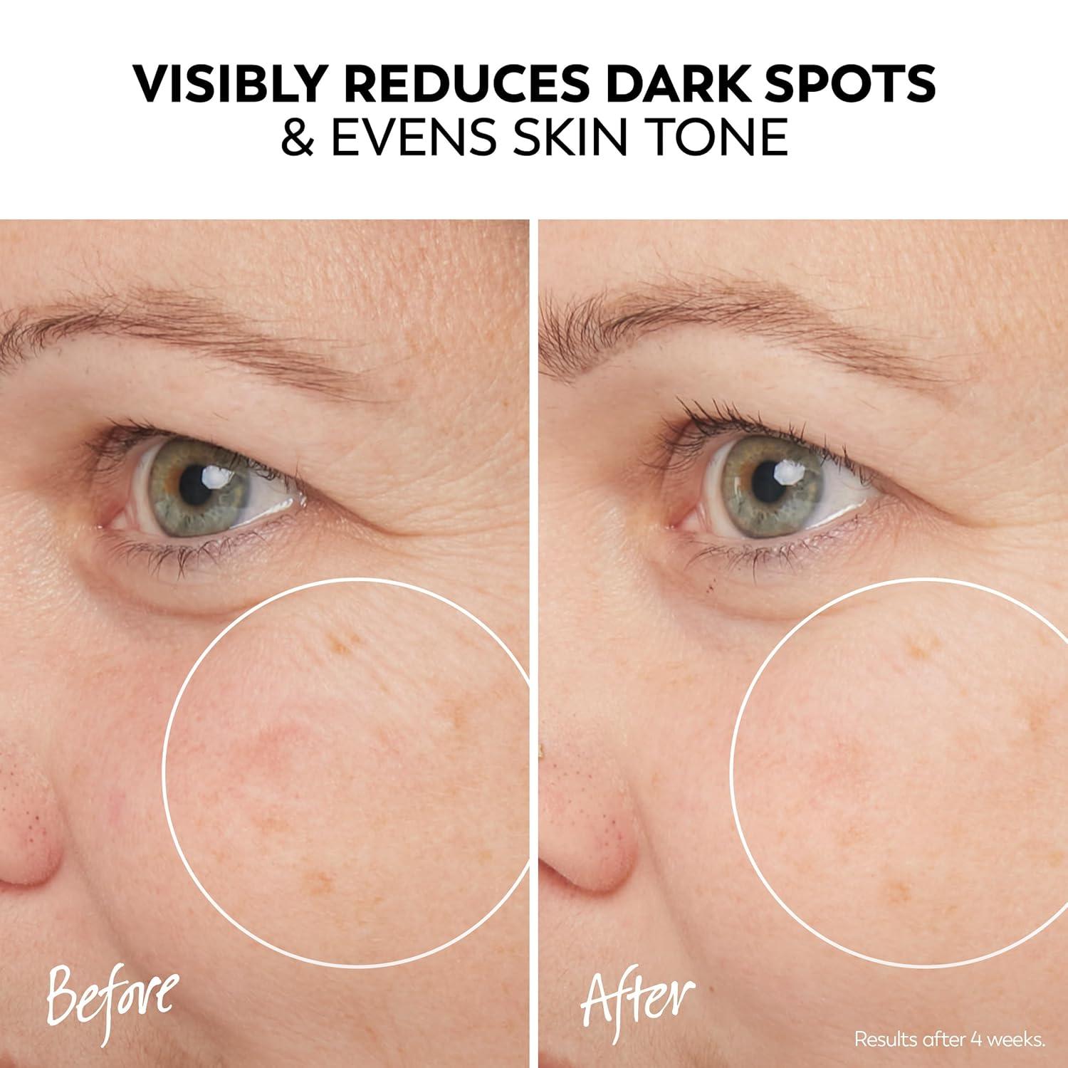 imageOlay Serum Regenerist Light Gel Face Moisturizer FragranceFree AntiAging AntiWrinkle Hydrating Firming Smoothening Improves Fine Lines and Elasticity Amino Peptide Complex 17 ozProX Serum
