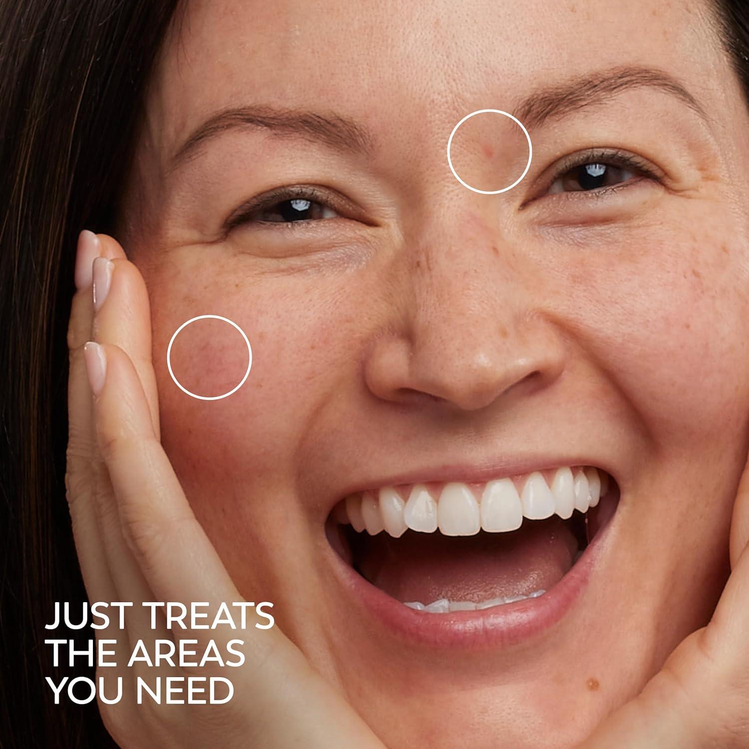 imageOlay Serum Regenerist Light Gel Face Moisturizer FragranceFree AntiAging AntiWrinkle Hydrating Firming Smoothening Improves Fine Lines and Elasticity Amino Peptide Complex 17 ozProX Serum